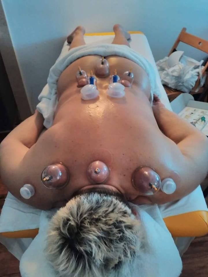 Баночний масаж спини